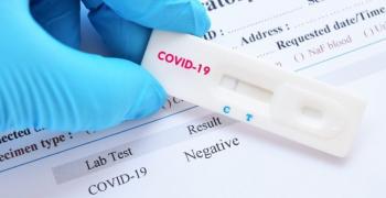 151 са новите случаи с COVID-19