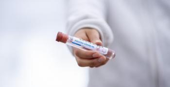 677 са новите случаи на коронавирус