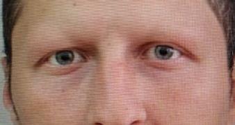 Издирват мъж, напуснал самоволно дом за хора с психични разстройства в Твърдица
